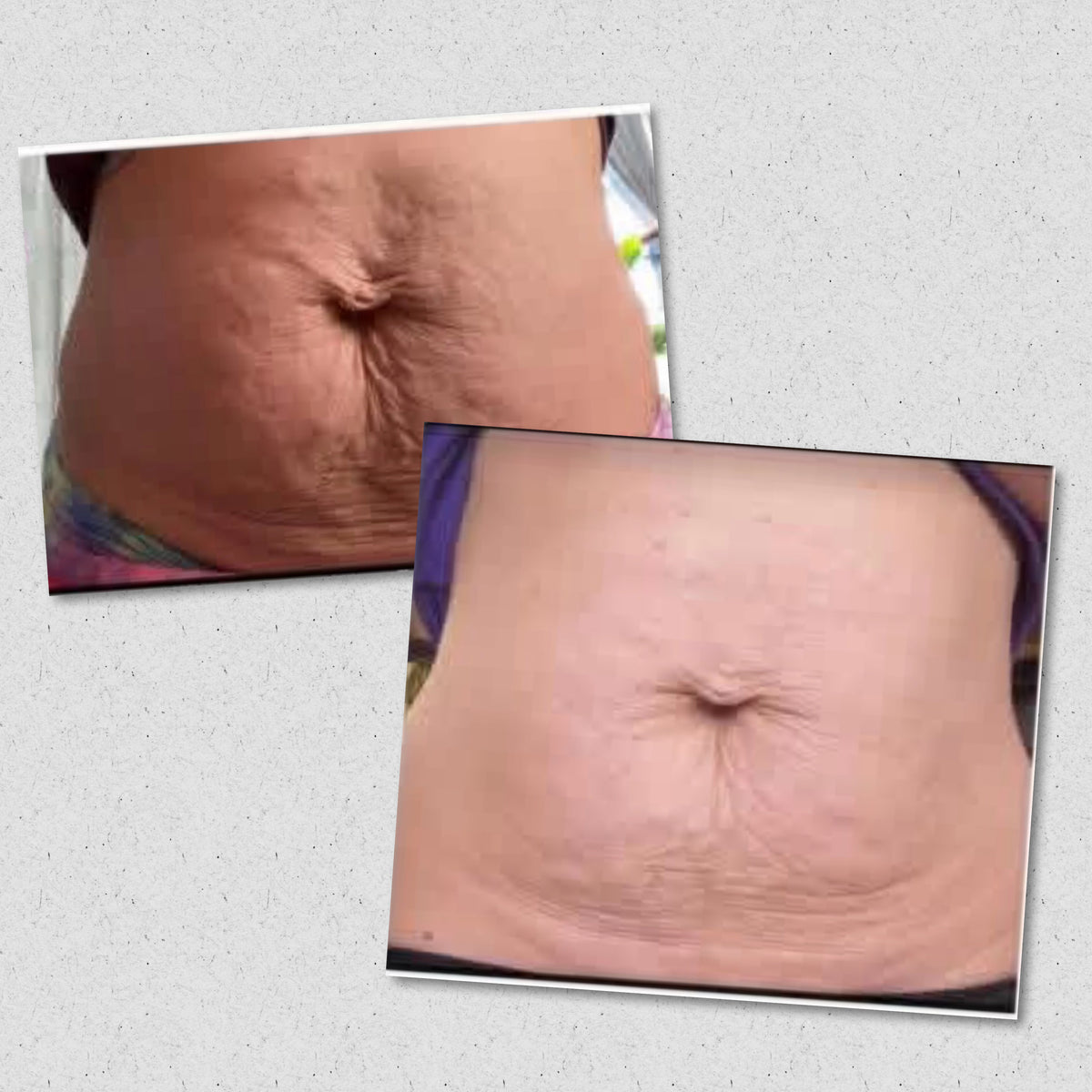 Coke Bottle Physique Cream